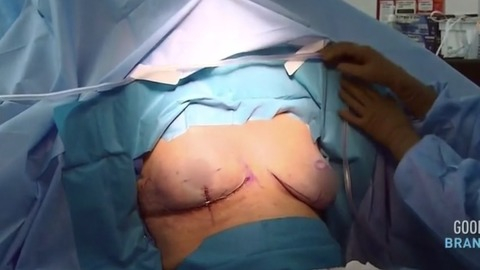 Pic: Nicole Eggert in Botched