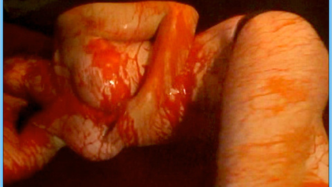 Pic: Carey Sveen in Meat Weed Madness