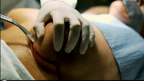 Pic: Kate French in Sutures