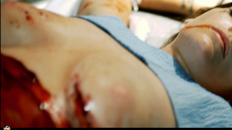 Pic: Kate French in Sutures