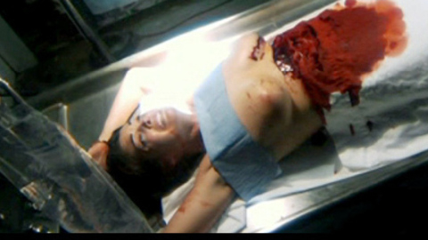 Pic: Kate French in Sutures