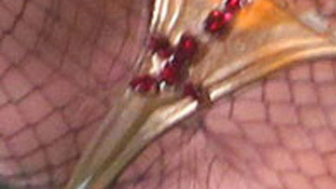 Pic: Kesha Rose Sebert in The Graham Norton Show (2007)