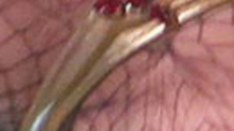 Pic: Kesha Rose Sebert in The Graham Norton Show (2007)