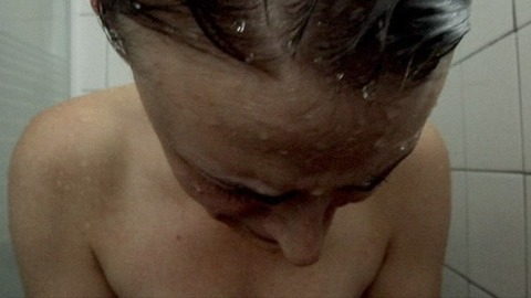 Pic: Lacy Fisher in Chemical Peel