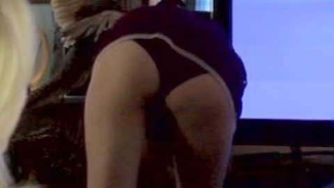 Pic: Arielle Brachfeld in Chemical Peel