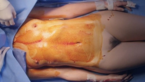 Pic: Anne Dorval in Heal the Living