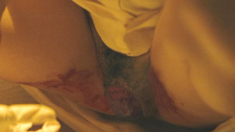 Pic: Erica Cho in Dead Ringers