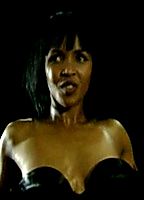 Celebrity: Dawn Matthews