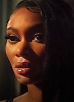 Celebrity: Winnie Harlow