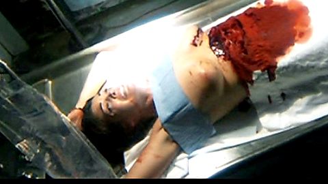 Pic: Kate French in Sutures (2009)