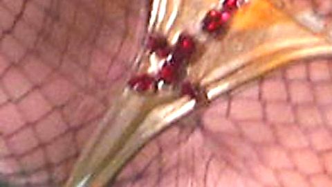 Pic: Kesha Rose Sebert in The Graham Norton Show (2007)