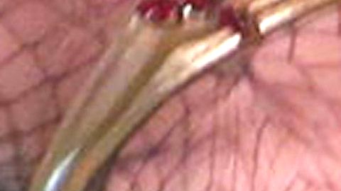 Pic: Kesha Rose Sebert in The Graham Norton Show (2007)