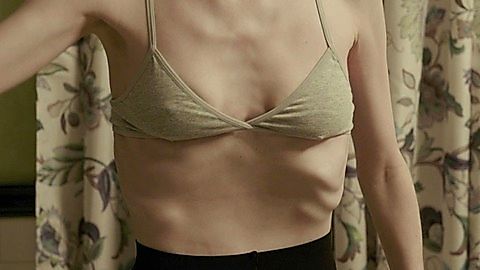 Pic: Lily Collins in To the Bone (2017)