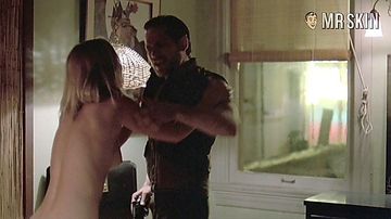 48Hrs-Crosby-MrSkin-Skinvision-HD-01_large_thumbnail_3_override.jpg?quality=80&1715609937&width=360&s=bdbb96e5a6270df5132a747e34a74e29851a4fa8c3d8d51552a647897f2787cd