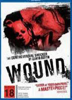 Title: Wound (2010)