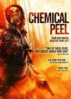 Title: Chemical Peel (2014)