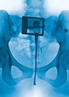 Title: Hammer (2025)